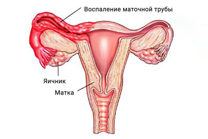 Аннексит