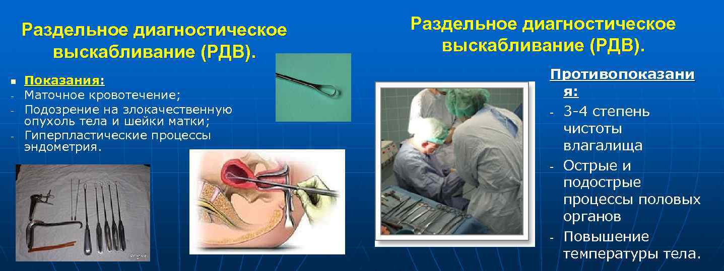 Очистка матки при кровотечении у женщин